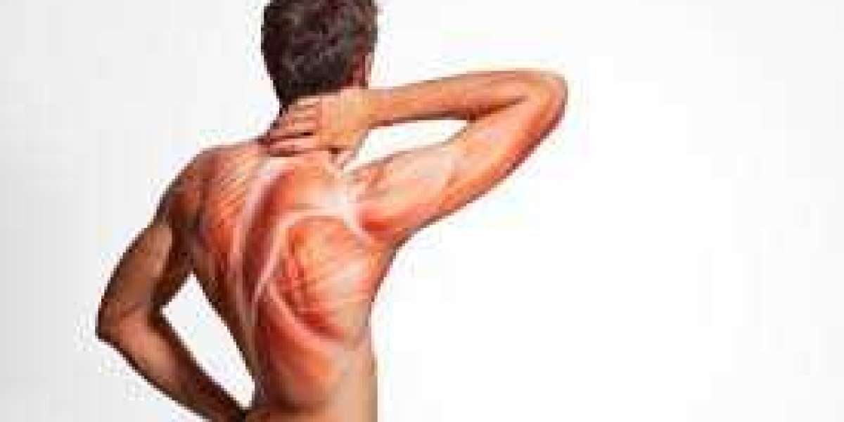 Understanding the Uses of Prosoma 350mg and 500mg in Muscle Pain Treatment